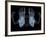 Skeleton From Below, X-ray Artwork-David Mack-Framed Photographic Print