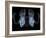 Skeleton From Below, X-ray Artwork-David Mack-Framed Photographic Print