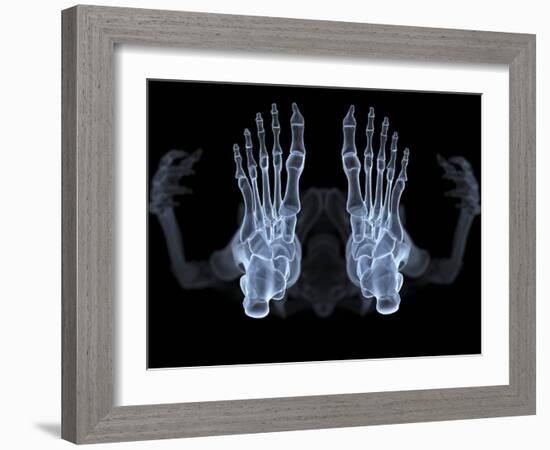 Skeleton From Below, X-ray Artwork-David Mack-Framed Photographic Print