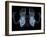 Skeleton From Below, X-ray Artwork-David Mack-Framed Photographic Print