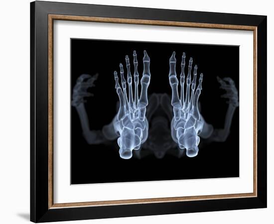 Skeleton From Below, X-ray Artwork-David Mack-Framed Photographic Print