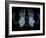 Skeleton From Below, X-ray Artwork-David Mack-Framed Photographic Print