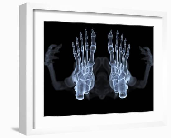 Skeleton From Below, X-ray Artwork-David Mack-Framed Photographic Print