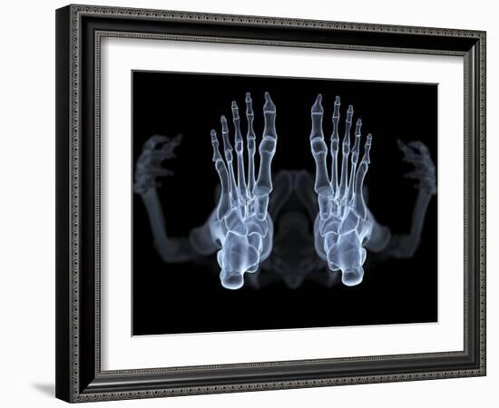 Skeleton From Below, X-ray Artwork-David Mack-Framed Photographic Print