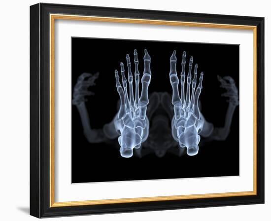 Skeleton From Below, X-ray Artwork-David Mack-Framed Photographic Print