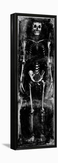 Skeleton I-Martin Wagner-Framed Stretched Canvas
