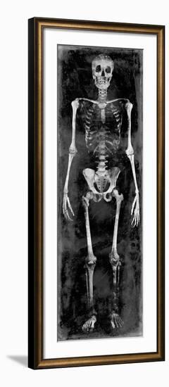 Skeleton II-Martin Wagner-Framed Art Print