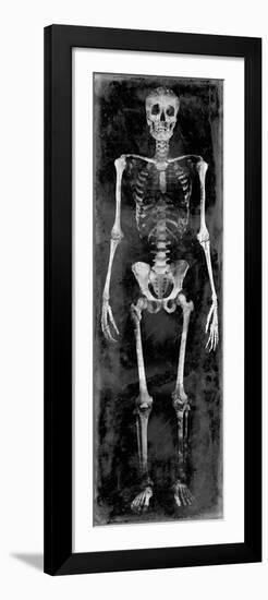 Skeleton II-Martin Wagner-Framed Art Print