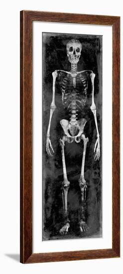 Skeleton II-Martin Wagner-Framed Art Print