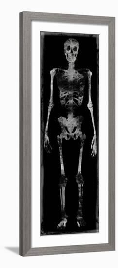 Skeleton III-Martin Wagner-Framed Art Print