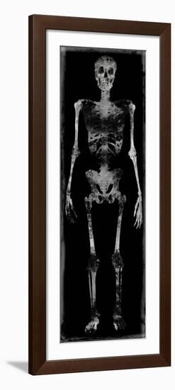 Skeleton III-Martin Wagner-Framed Art Print