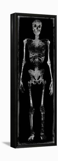 Skeleton III-Martin Wagner-Framed Stretched Canvas