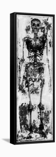 Skeleton IV-Martin Wagner-Framed Stretched Canvas