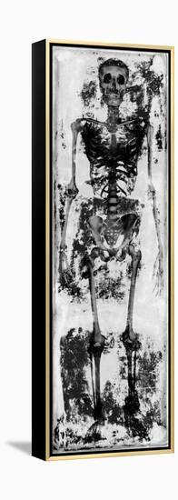 Skeleton IV-Martin Wagner-Framed Stretched Canvas