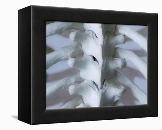 Skeleton spine and ribs-Robert Llewellyn-Framed Premier Image Canvas