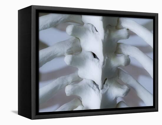 Skeleton spine and ribs-Robert Llewellyn-Framed Premier Image Canvas