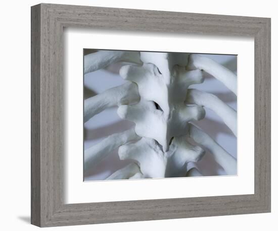 Skeleton spine and ribs-Robert Llewellyn-Framed Photographic Print