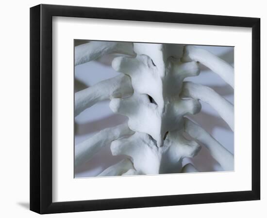 Skeleton spine and ribs-Robert Llewellyn-Framed Photographic Print