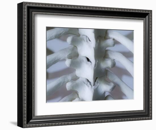 Skeleton spine and ribs-Robert Llewellyn-Framed Photographic Print