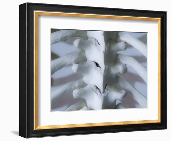 Skeleton spine and ribs-Robert Llewellyn-Framed Photographic Print