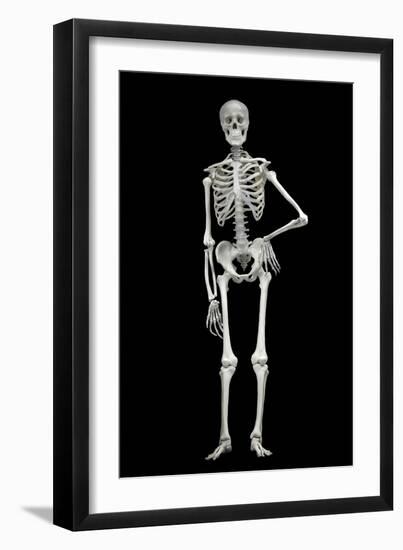 Skeleton-Linda Wright-Framed Photographic Print