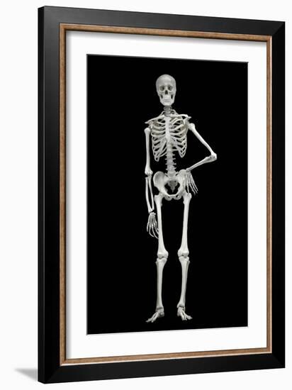 Skeleton-Linda Wright-Framed Photographic Print