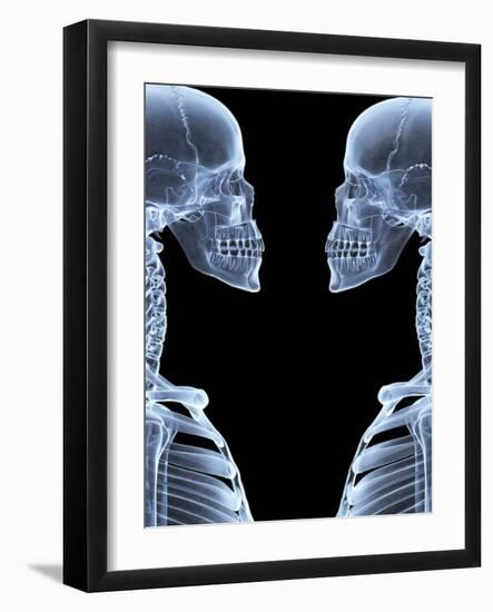 Skeletons, X-ray Artwork-David Mack-Framed Photographic Print