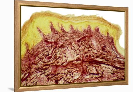 Skin Layers, Light Micrograph-Steve Gschmeissner-Framed Premier Image Canvas