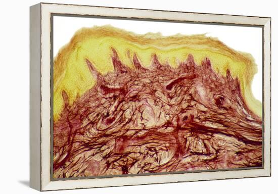 Skin Layers, Light Micrograph-Steve Gschmeissner-Framed Premier Image Canvas