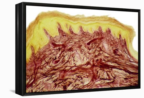 Skin Layers, Light Micrograph-Steve Gschmeissner-Framed Premier Image Canvas