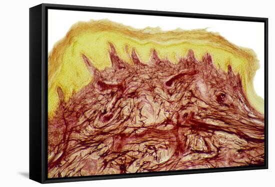 Skin Layers, Light Micrograph-Steve Gschmeissner-Framed Premier Image Canvas