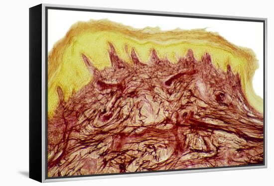 Skin Layers, Light Micrograph-Steve Gschmeissner-Framed Premier Image Canvas