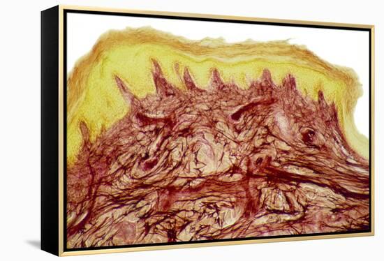 Skin Layers, Light Micrograph-Steve Gschmeissner-Framed Premier Image Canvas