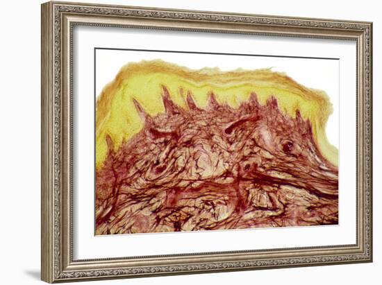 Skin Layers, Light Micrograph-Steve Gschmeissner-Framed Photographic Print