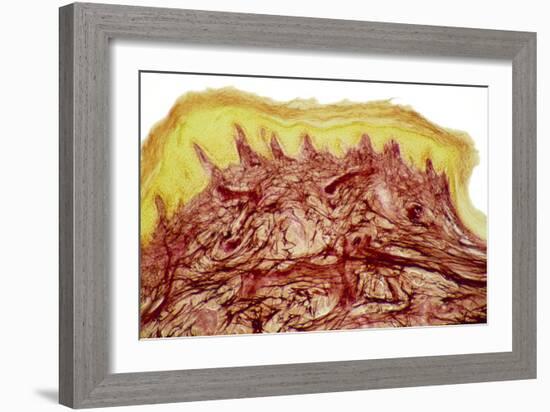 Skin Layers, Light Micrograph-Steve Gschmeissner-Framed Photographic Print