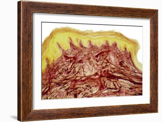 Skin Layers, Light Micrograph-Steve Gschmeissner-Framed Photographic Print