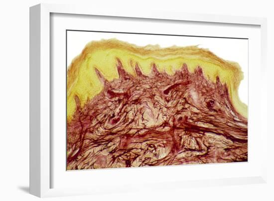 Skin Layers, Light Micrograph-Steve Gschmeissner-Framed Photographic Print