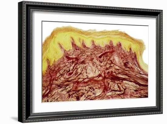 Skin Layers, Light Micrograph-Steve Gschmeissner-Framed Photographic Print