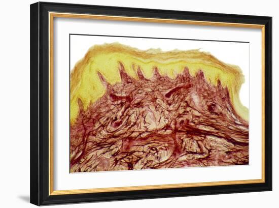 Skin Layers, Light Micrograph-Steve Gschmeissner-Framed Photographic Print