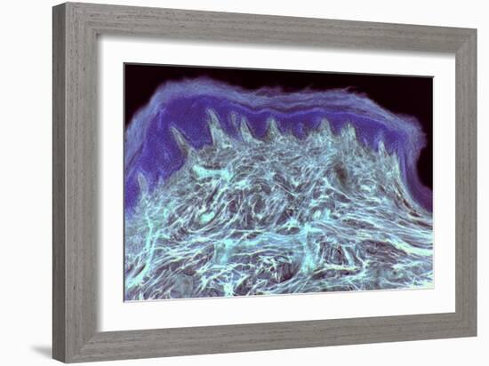 Skin Layers, Light Micrograph-Steve Gschmeissner-Framed Photographic Print