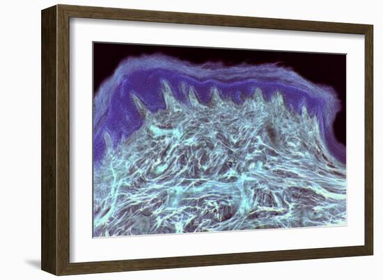 Skin Layers, Light Micrograph-Steve Gschmeissner-Framed Photographic Print