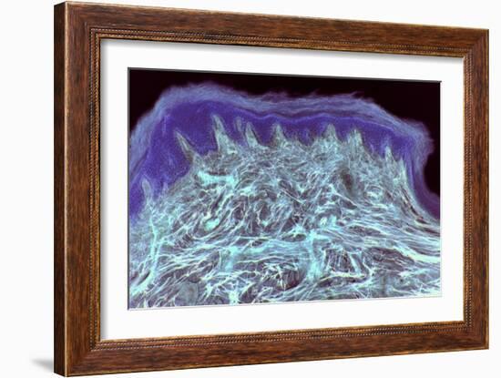 Skin Layers, Light Micrograph-Steve Gschmeissner-Framed Photographic Print