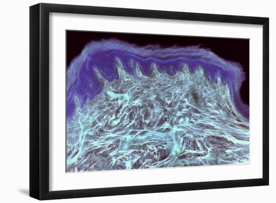 Skin Layers, Light Micrograph-Steve Gschmeissner-Framed Photographic Print