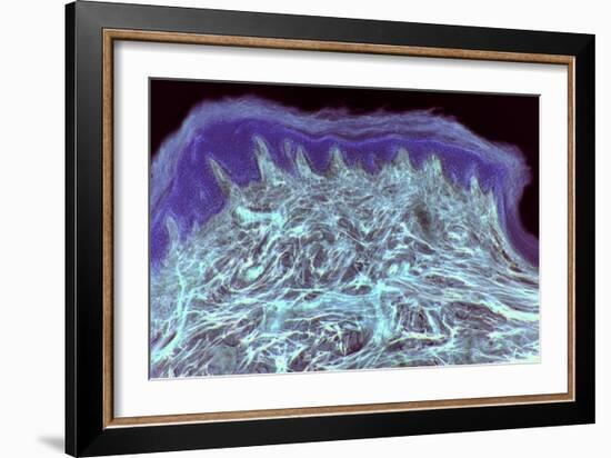 Skin Layers, Light Micrograph-Steve Gschmeissner-Framed Photographic Print