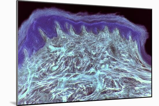 Skin Layers, Light Micrograph-Steve Gschmeissner-Mounted Photographic Print