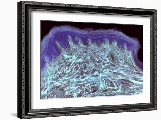 Skin Layers, Light Micrograph-Steve Gschmeissner-Framed Photographic Print