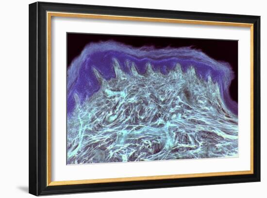 Skin Layers, Light Micrograph-Steve Gschmeissner-Framed Photographic Print