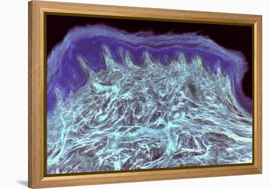 Skin Layers, Light Micrograph-Steve Gschmeissner-Framed Premier Image Canvas