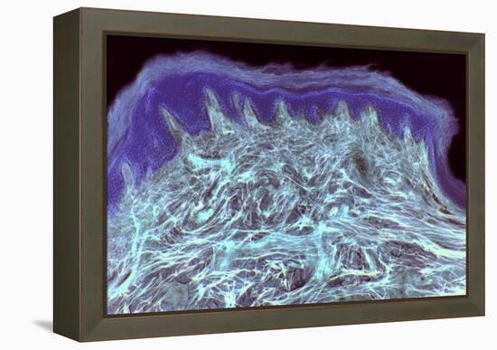 Skin Layers, Light Micrograph-Steve Gschmeissner-Framed Premier Image Canvas