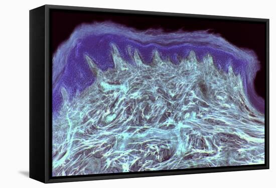 Skin Layers, Light Micrograph-Steve Gschmeissner-Framed Premier Image Canvas